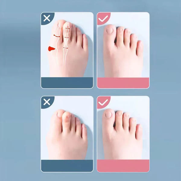 Silicone Toe Alignment Solutions™