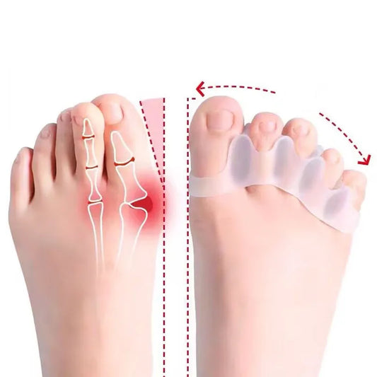 Silicone Toe Alignment Solutions™